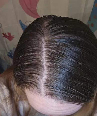 Aplicación del sérum capilar VT Cosmetics en la raíz