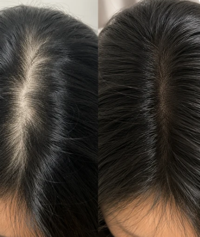 Distribución del sérum VT Cosmetics con brocha integrada