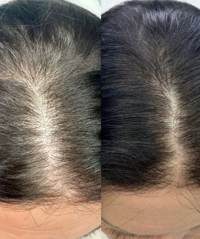 Rutina de cuidado del cuero cabelludo con VT Cosmetics