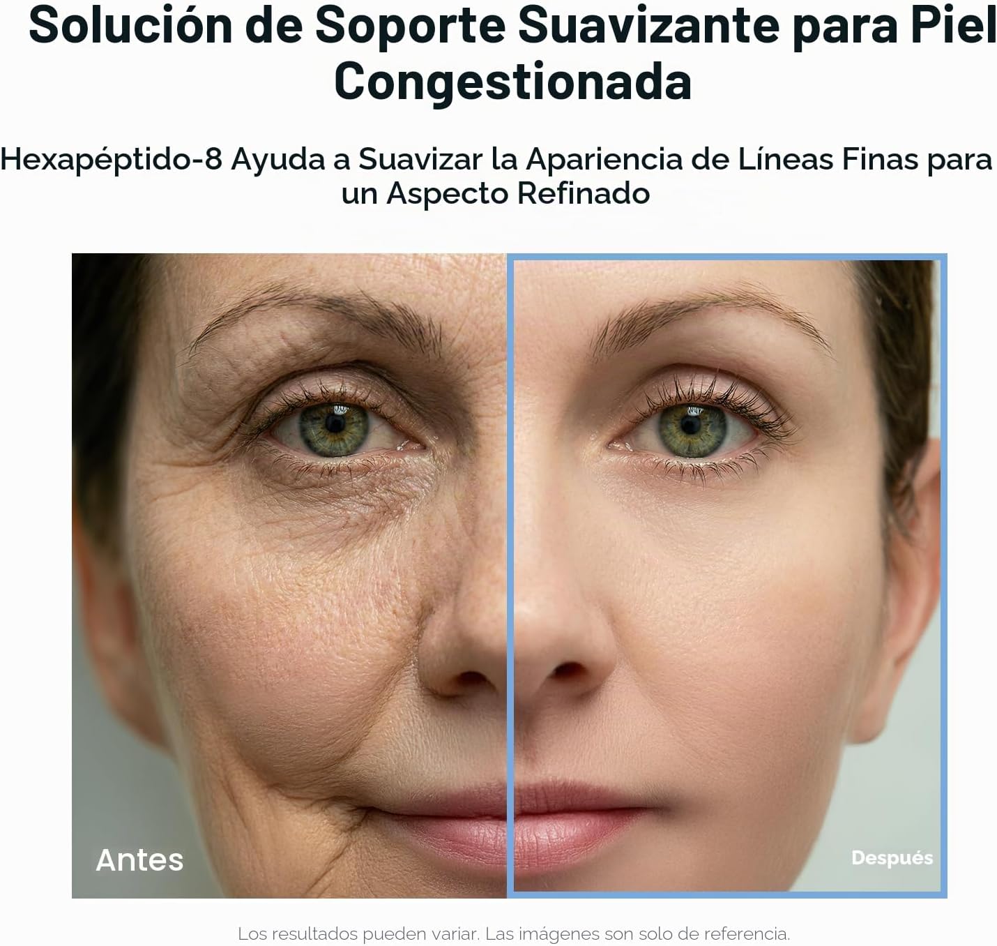 Antes y después del cuidado con SUNGBOON EDITOR